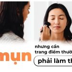 Bị mụn nhưng cần trang điểm thường xuyên, phải làm thế nào?