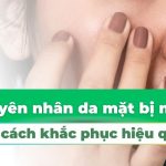 Nguyên nhân da mặt bị ngứa và cách khắc phục hiệu quả