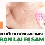 Vì sao người ta dùng retinol thì đẹp, còn bạn lại bị sạm đen?