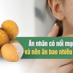 Ăn nhãn có nổi mụn không và nên ăn bao nhiêu là vừa đủ?