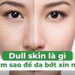 Dull skin là gì và làm sao để da bớt xỉn màu?