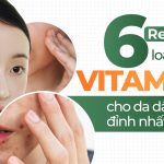 Review 6 loại serum vitamin C cho da dầu mụn đỉnh nhất hiện nay
