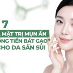 Top 7 sữa rửa mặt trị mụn ẩn “đáng đồng tiền bát gạo” dành cho da sần sùi