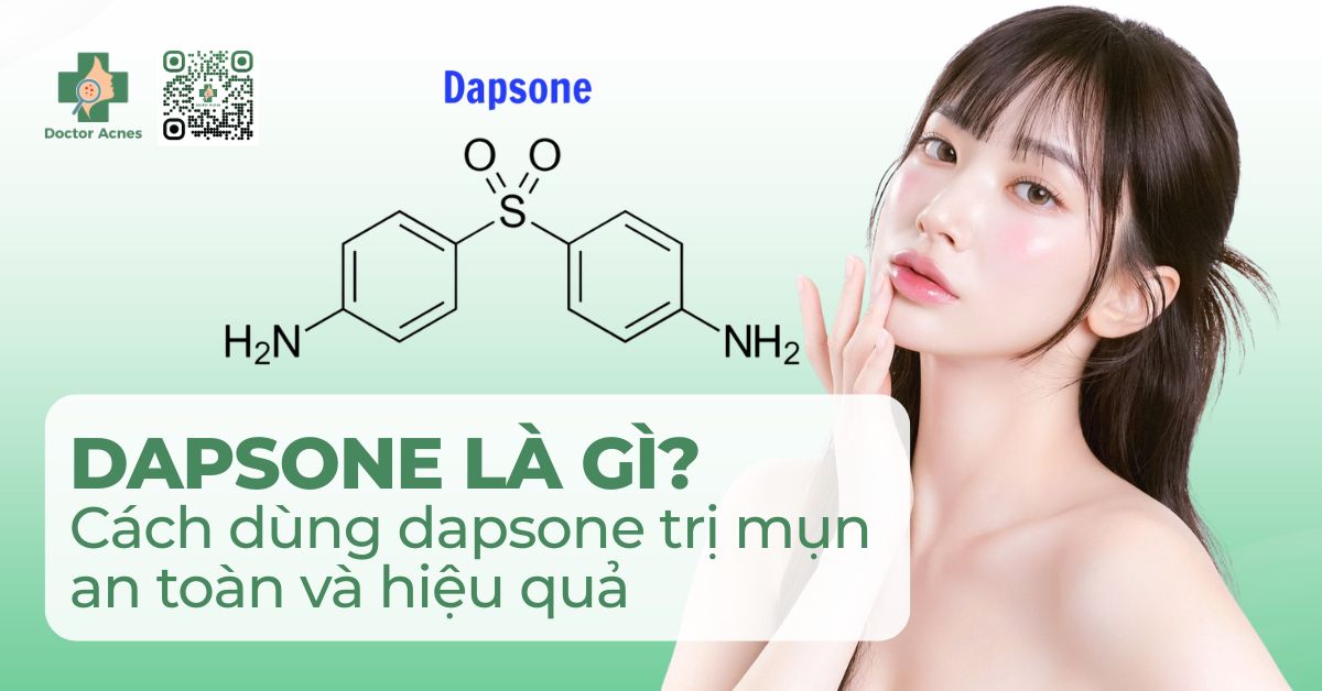 Dapsone là gì? Cách dùng dapsone trị mụn an toàn và hiệu quả - Phòng ...