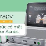 Ultherapy Prime chính thức có mặt tại Doctor Acnes