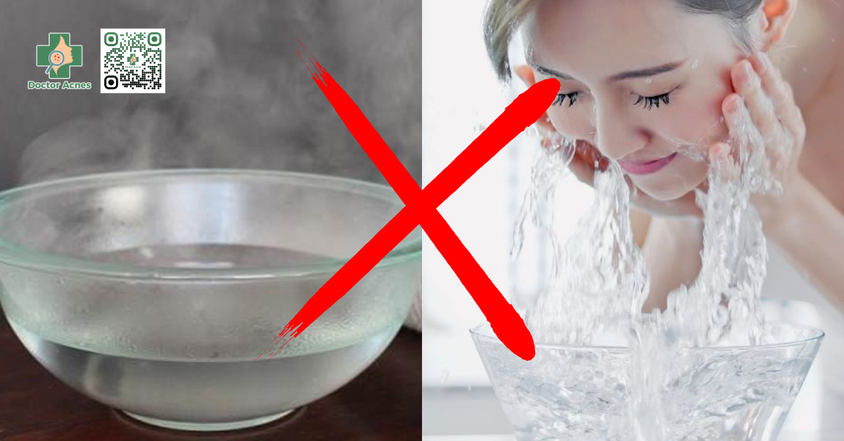 Không rửa mặt với nước quá nóng