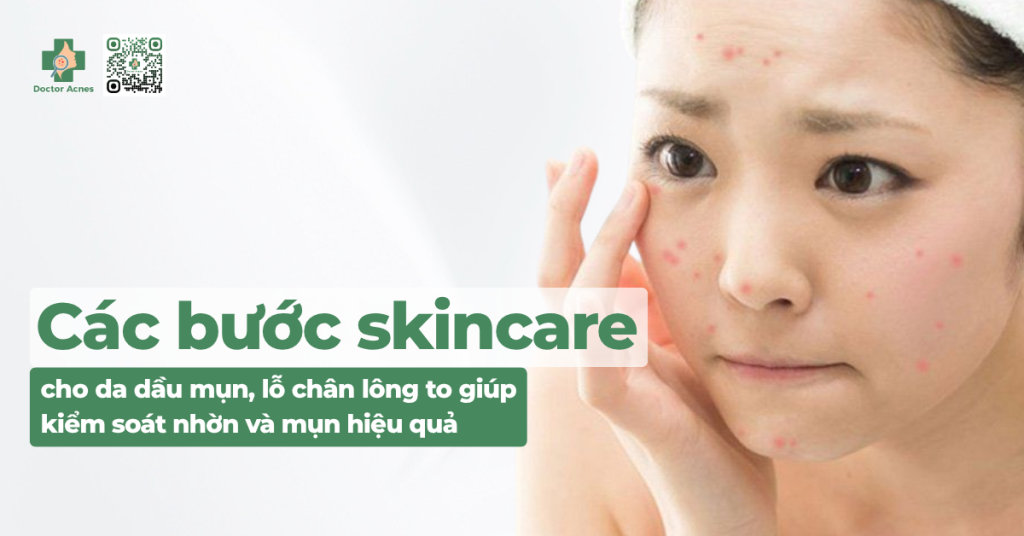 thumb Các bước skincare cho da dầu mụn, lỗ chân lông to giúp kiểm soát nhờn và mụn hiệu quả