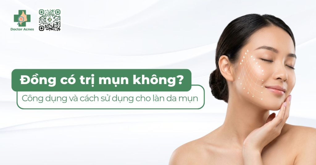 thumb Đồng có trị mụn không Công dụng và cách sử dụng cho làn da mụn